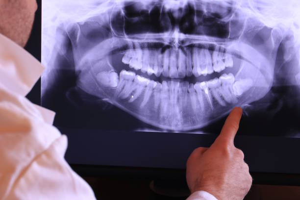 Best Emergency Treatment for Toothache in Christiansburg, VA