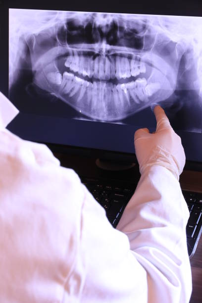 Best Emergency Tooth Extraction in Christiansburg, VA