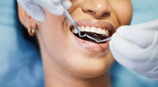 Best Emergency Treatment for Toothache in Christiansburg, VA