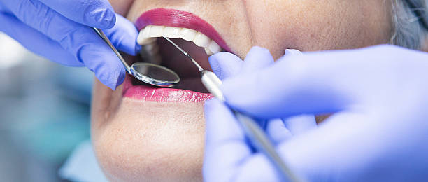 Best Emergency Broken Tooth Repair in Christiansburg, VA